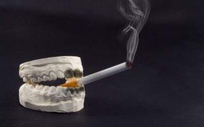 Smoking and Dental Implants Don’t Go