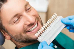 shaved teeth for veneers colour