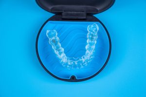 Invisalign Vs veneers orthodontic aligners