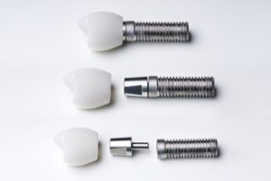 dental implants turkey parts