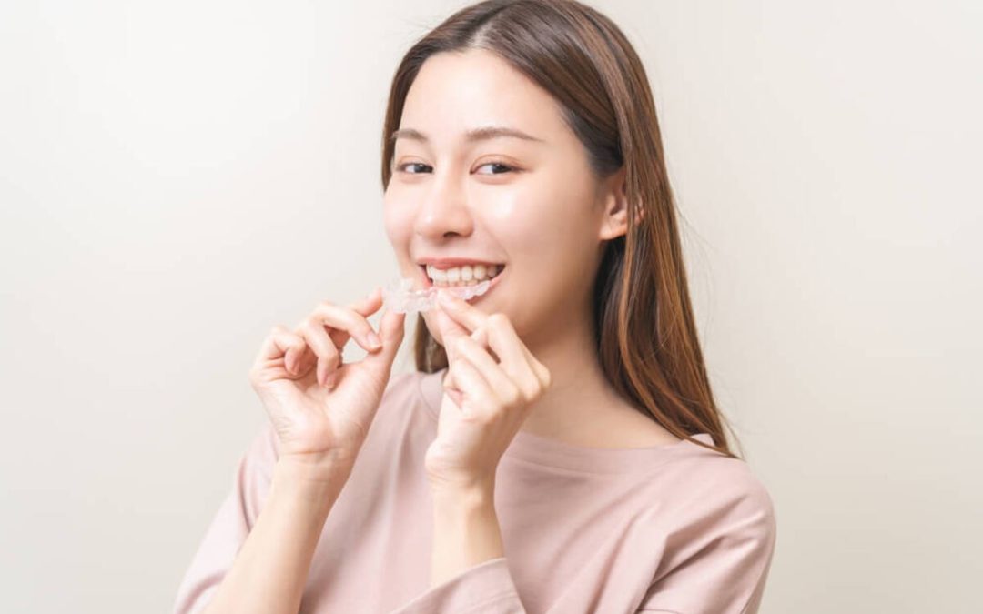 How Much Does Invisalign Cost? Key Factors You Should Know