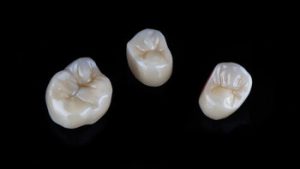 dental crown cost procedure porcelain